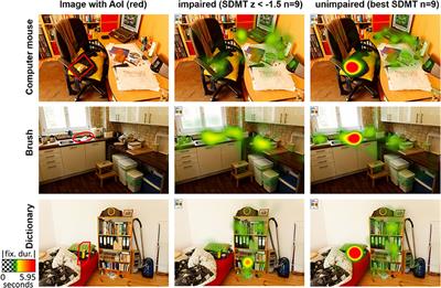 Visual Search in Naturalistic Scenes Reveals Impaired Cognitive Processing Speed in Multiple Sclerosis